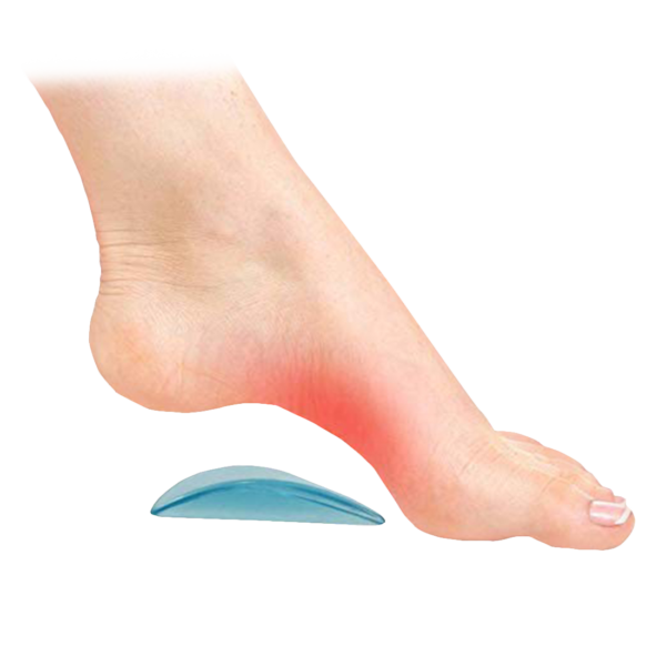 Best Arch Support for Plantar Fasciitis: Your Ultimate Guide
